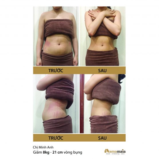 Hình ảnhKinh nghiệm giảm béo sau sinh 1 tháng hiệu quả